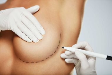 Breast Reduction Surgery in Thailand